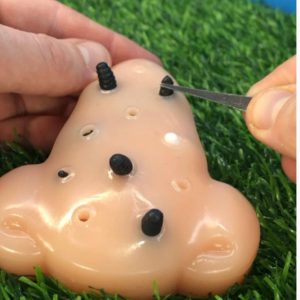 Blackhead Spot Popper Fidget