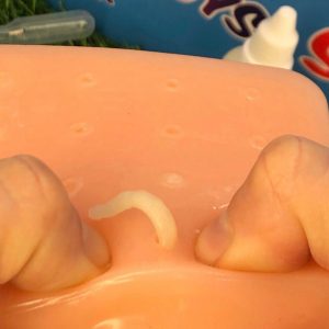 Pimple Popper Fidget